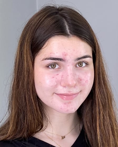 Ava Espinal Missing Since Jun 25, 2025 From Brookline, MA