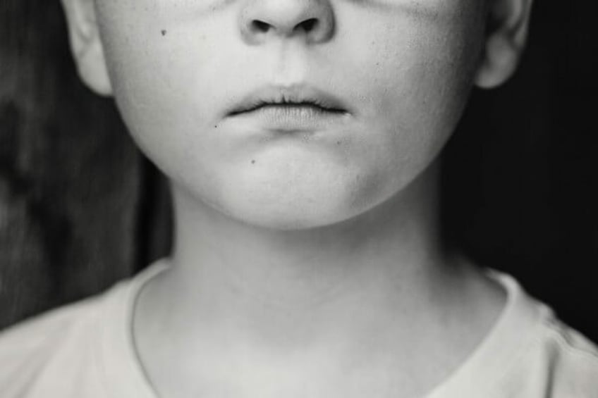 child abuse affects brain development study reveals complex trauma related to psychopathology and cognitive illness