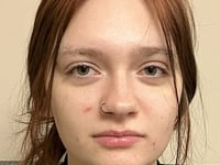 Kara Lorman пропала без вести июл 17, 2025 в Fort Edward, NY